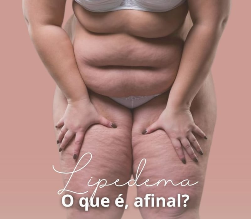 Lipedema