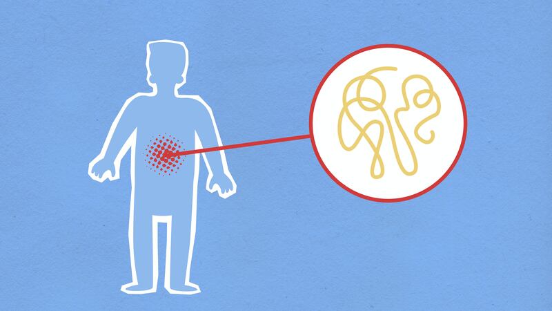 Cambios en la microbiota intestinal