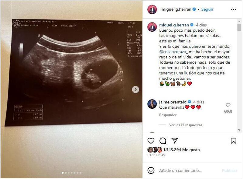 Miguel Herrán está muy emocionado con la llegada de su primer bebé